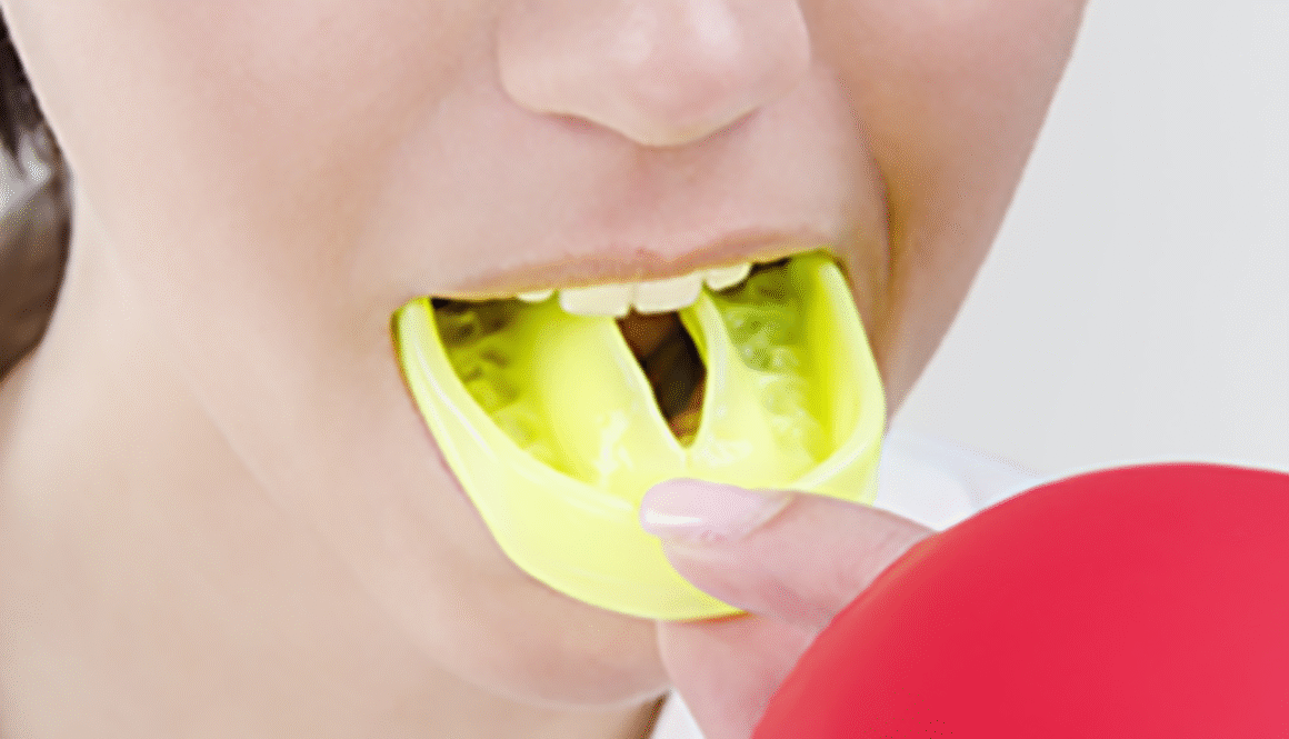 benefits-custom-fitted-mouthguard