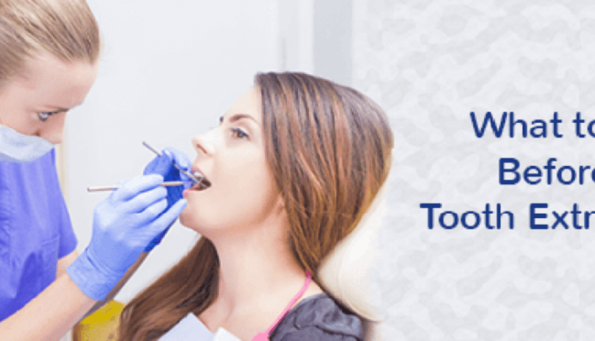 what-to-do-before-a-tooth-extraction