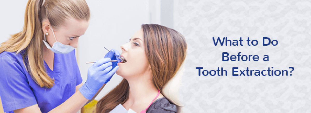 what-to-do-before-a-tooth-extraction