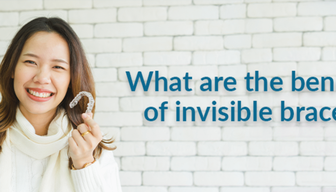 What-are-the-benefits-of-invisible-braces