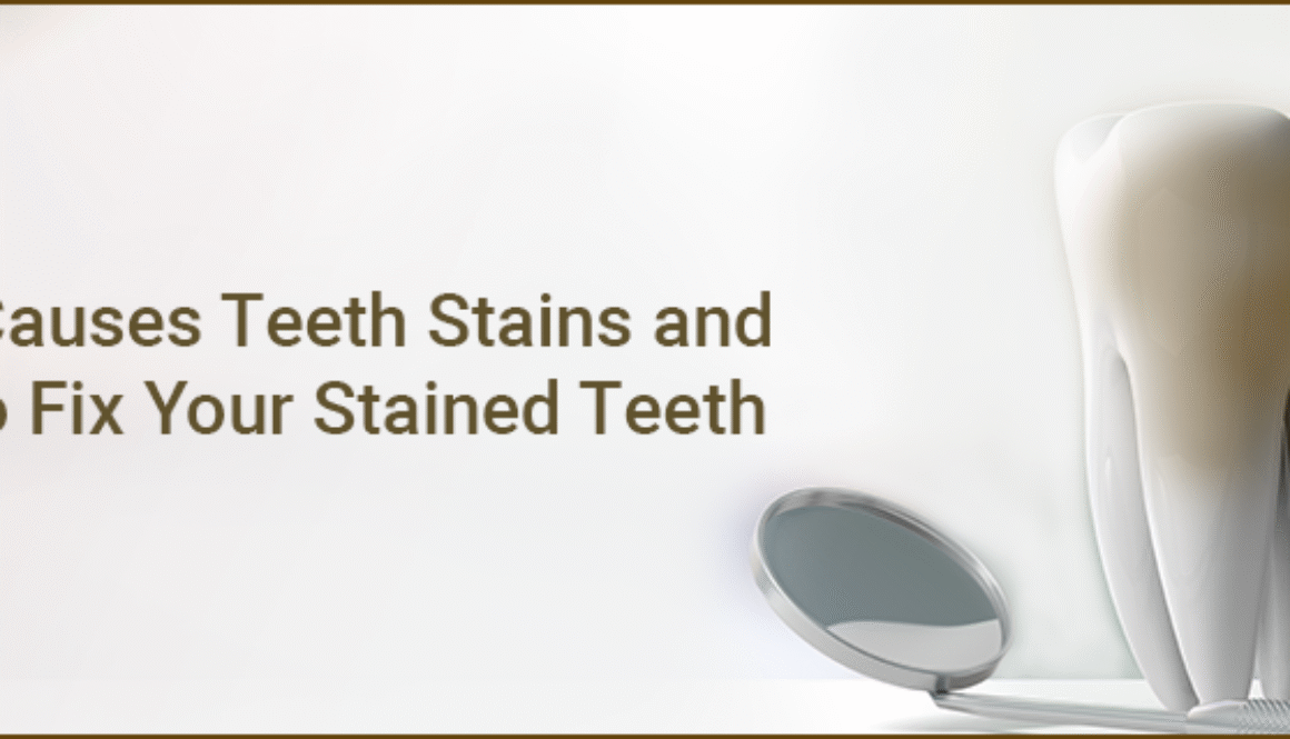 teeth-stains-new
