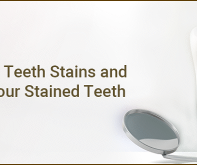 teeth-stains-new