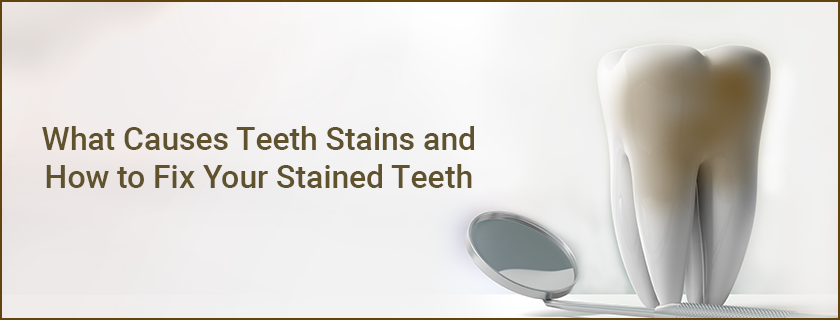 teeth-stains-new
