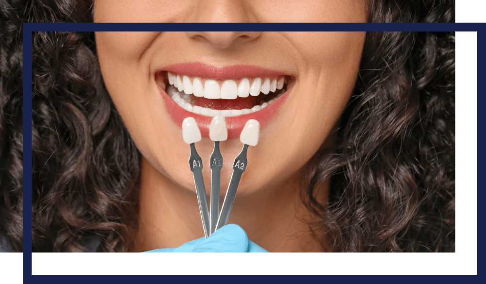 dentistry-cosmetic--veneers