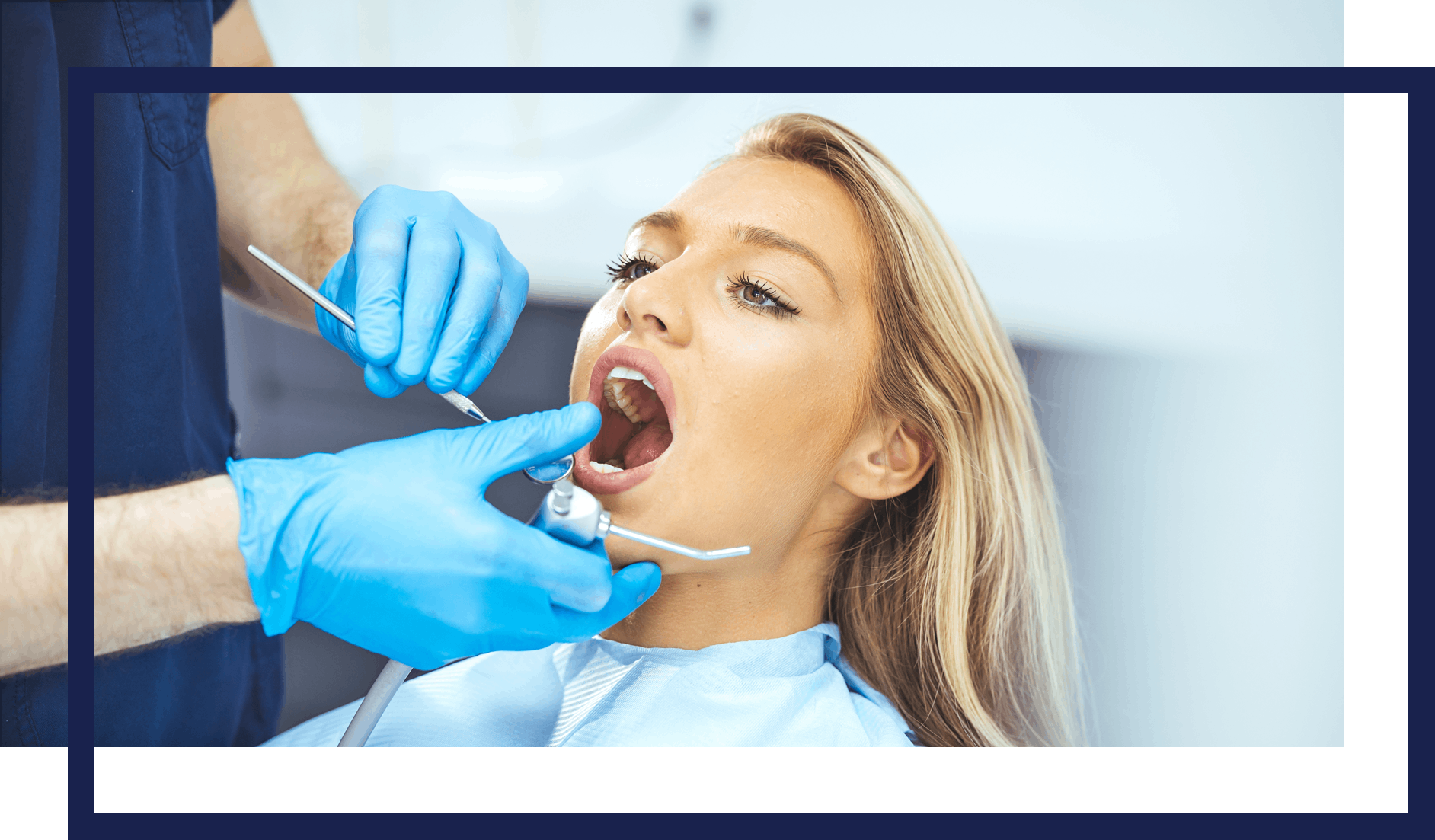 dentistry-genera--filling